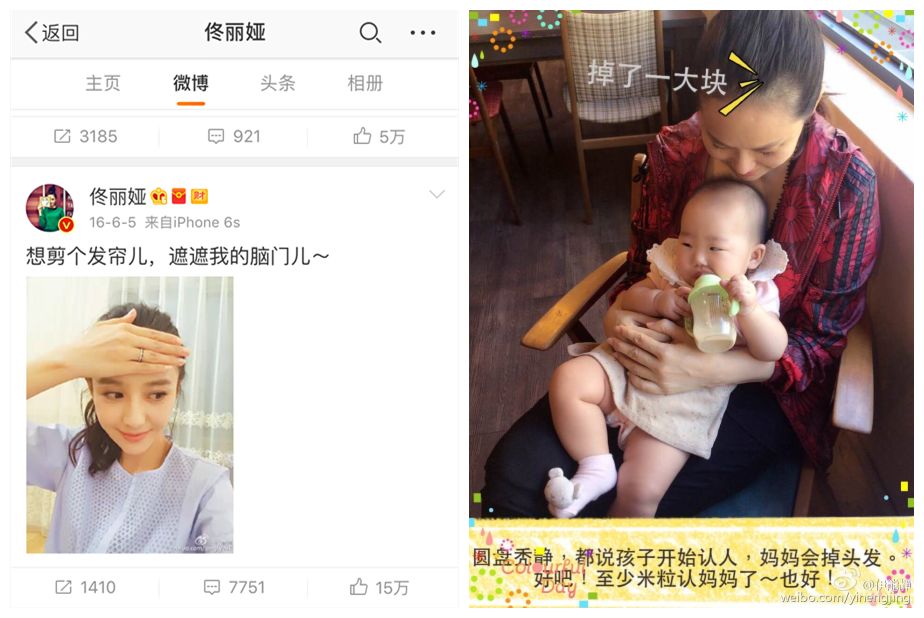 产后发际线后移怎么办,产后脱发发际线脱得最厉害