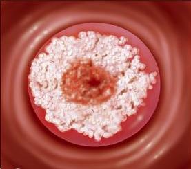 女性出现这些情况要注意,女人一旦有了这十种表现