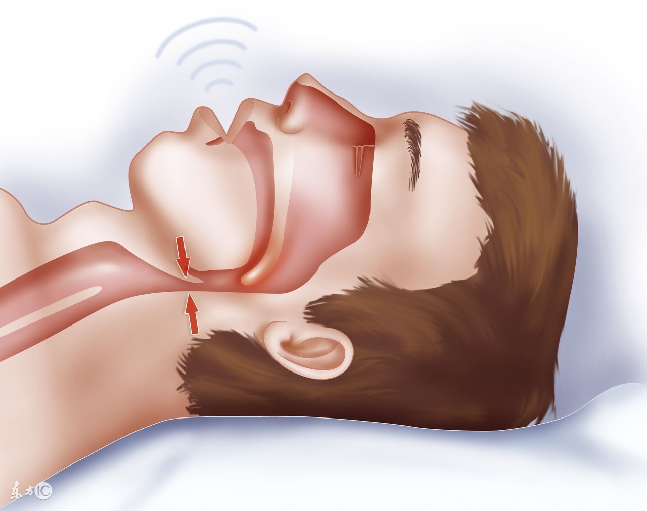 长期服用安眠类药物的副作用,安神助眠的药能长期吃吗