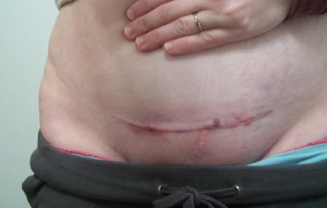 老一辈在家生孩子，现在产妇却要被侧切一刀，胎儿的头部变大了吗