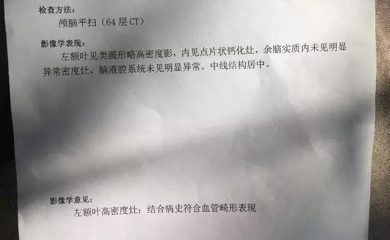 脑动静脉畸形引起的癫痫怎么治疗,脑动静脉畸形介入栓塞治愈率