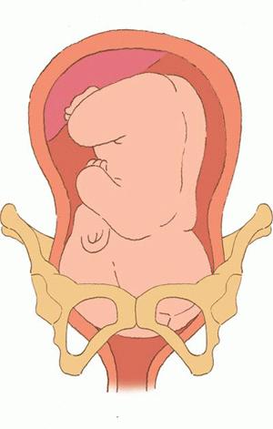 孕妇大肚子在水中分娩过程,中国孕妇在水中分娩过程