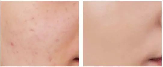 超模都在用的粉底液,美妆博主推荐的超模粉底液