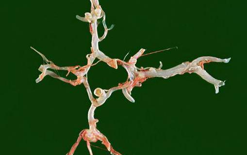 脑中风早期要花多少钱治好呢,脑中风一招救命