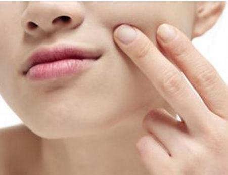 嘴角纹有什么办法去除,嘴角纹怎么消除吃什么食物好