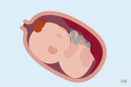 35周孕妈为什么会破水,孕妇36周羊水一直少