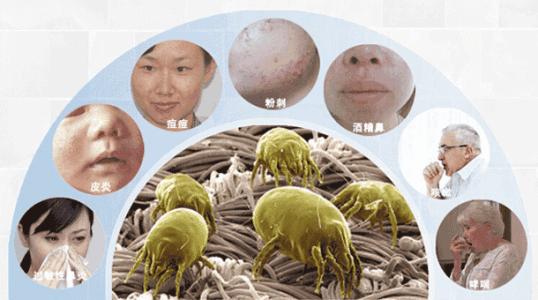 宝宝螨虫感染皮肤的症状,螨虫感染皮肤瘙痒怎么办