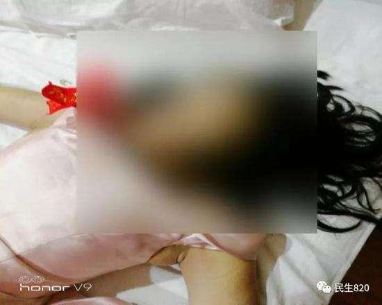 因疑被劝酒导致17岁伴娘身亡,喝喜酒发生酒精中毒谁负责