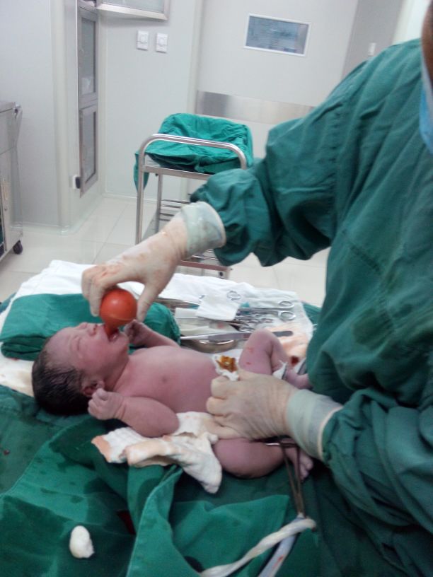 羊水偏少胎儿偏大能顺生吗,羊水偏少的胎儿