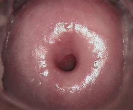 宫颈的问题，这方面可不能偷懒！