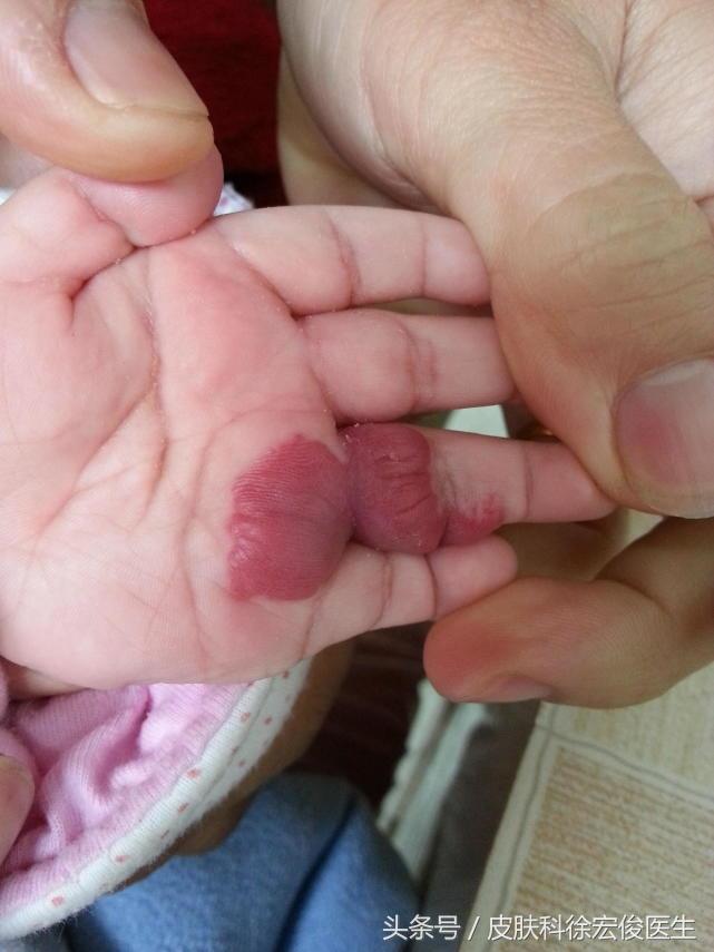 7种常见皮肤科用药便宜又好用,皮肤科常用好用实用的药品