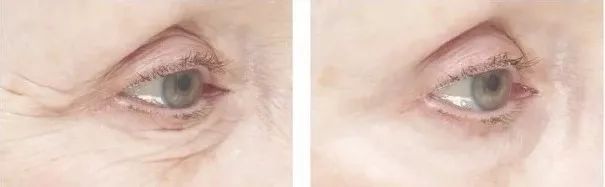 全网公认最好面膜不带货,不输大牌的平价面膜99十盒