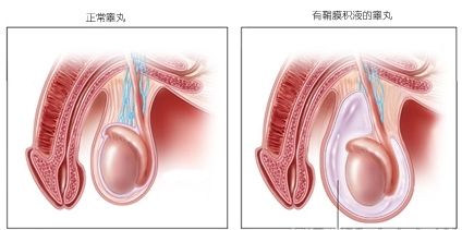 男人“蛋蛋”越大越好？小心这几种病！