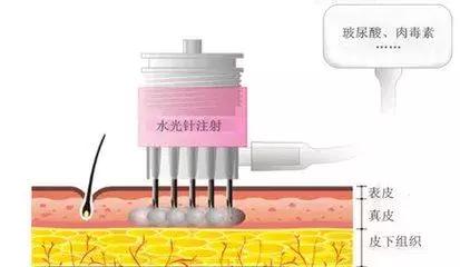 李沁活动把自己P白了N个度，这种肤色不均是不是没救了？