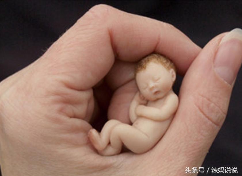 黄疸皮肤黄怎么办,宝宝黄疸退了皮肤为什么还是黄