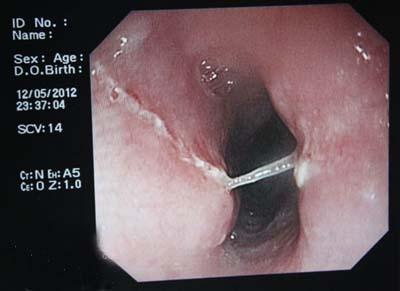 欢欢喜喜过大年吃美食,欢欢喜喜过大年吃什么