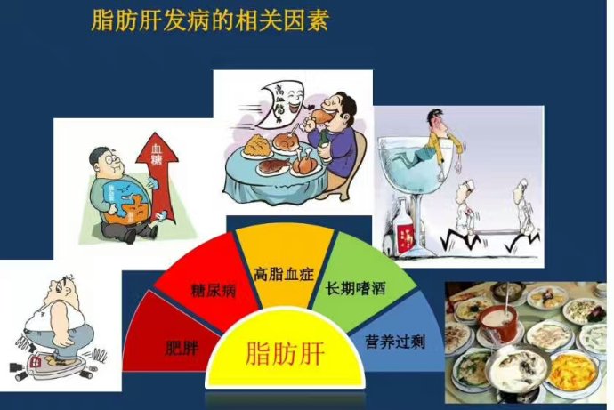 脂肪肝如何确诊,治疗脂肪肝有一个很巧妙的方法