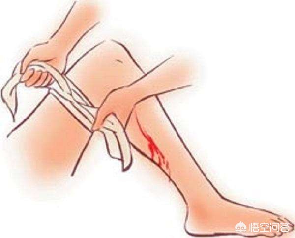 不小心被烟花伤到手了怎么办,不小心被炮竹伤到眼睛怎么办