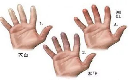 拔牙后浑身发冷是什么原因,浑身发冷嗓子疼是什么原因