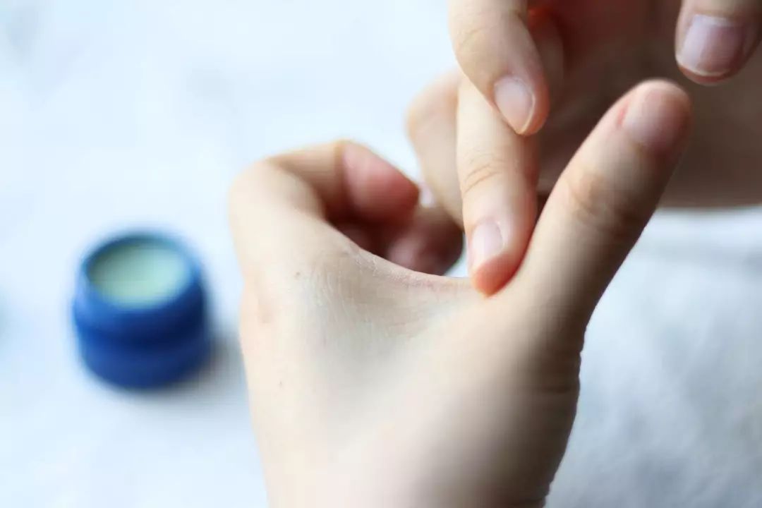 男士嘴唇干裂脱皮怎么回事,男士嘴唇干裂脱皮怎么办