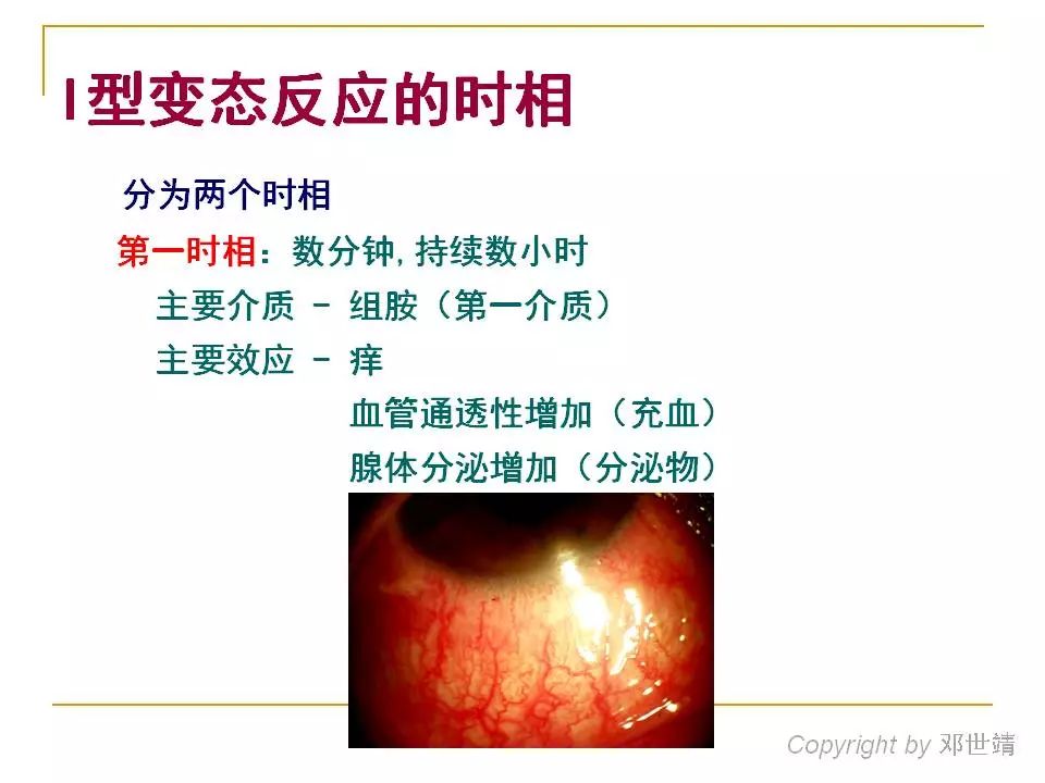 眼周过敏中医治疗,眼周过敏的症状图片