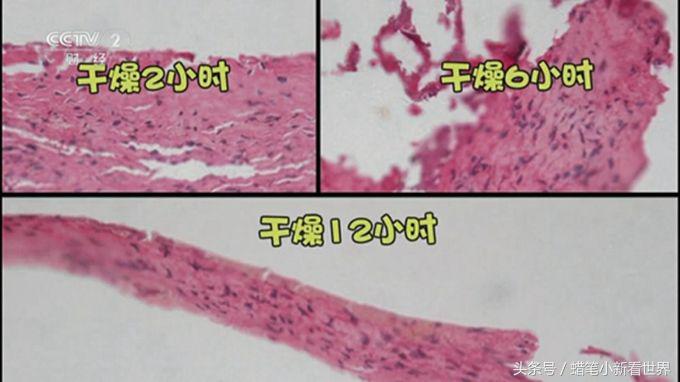 牙齿外伤撞掉多久可以种植,如果牙齿被撞掉的话还可以长出来