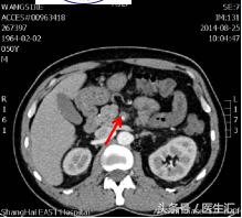 呕吐出咖啡色液体?别再忍着了!
