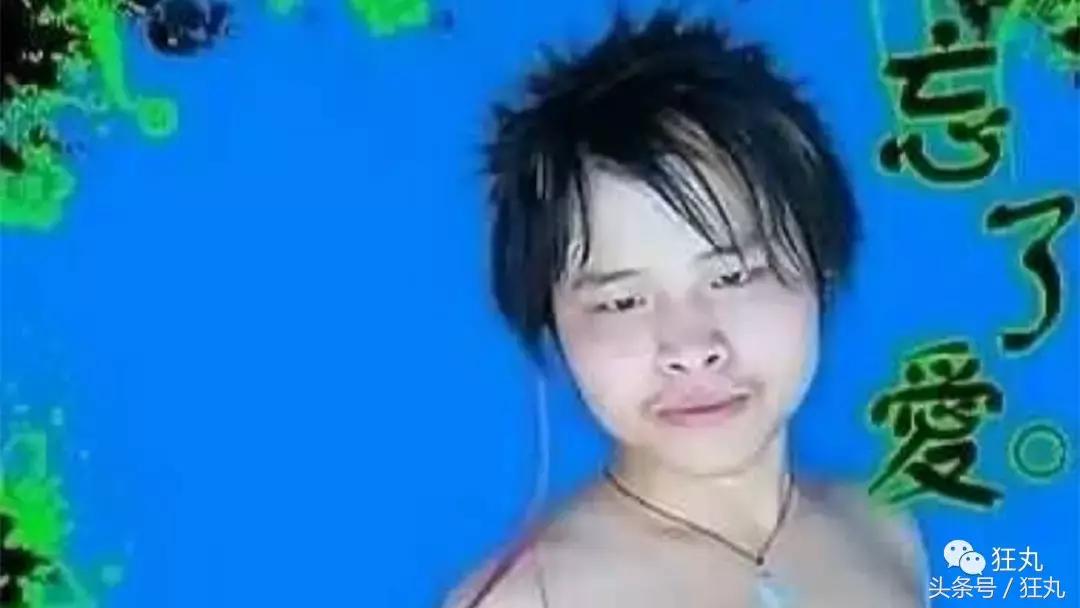 麦当劳薯条治疗脱发,麦当劳薯条掉头发