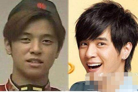 女明星都用双眼皮贴,为什么女明星用双眼皮贴