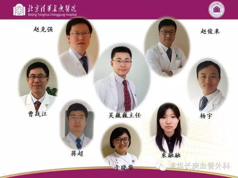 北京医院静脉曲张微创手术,清华长庚静脉曲张