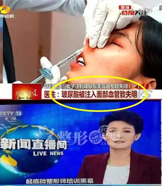 韩国微整证书国内承认吗,韩国黑心整容医院