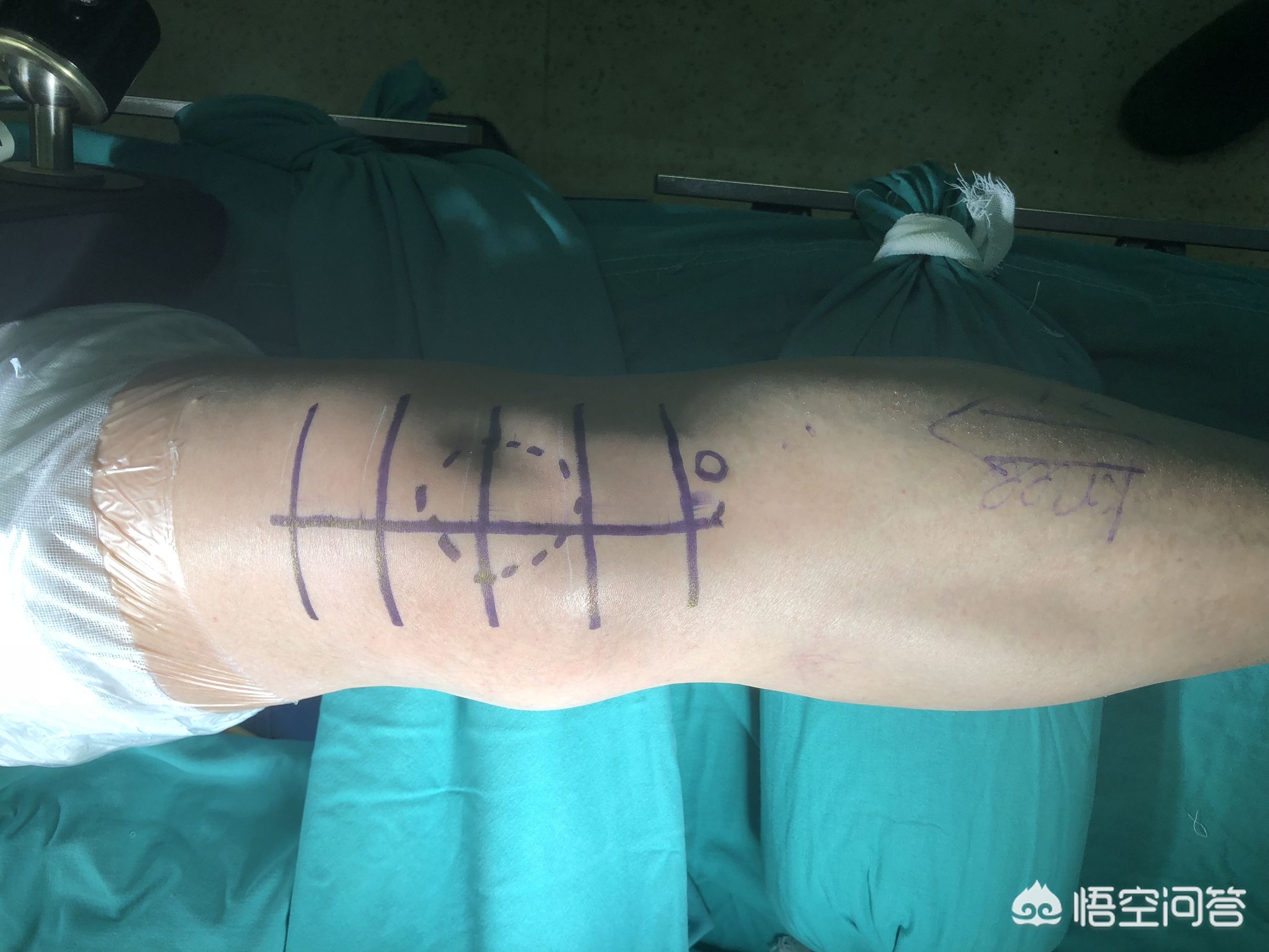 为什么医生做手术血不会一直流,为什么医生做手术不紧张