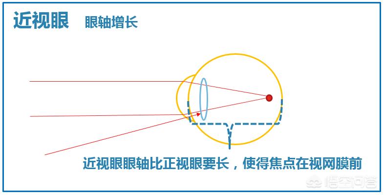 晚上如何远眺防近视,为什么远眺有助于预防近视