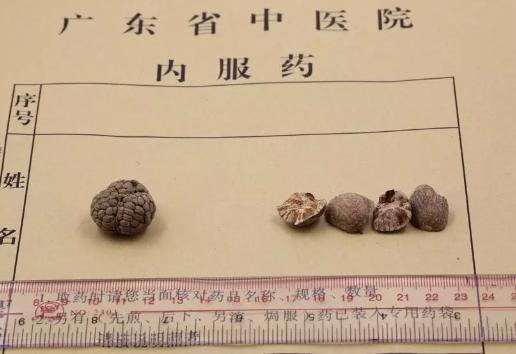 各种豆蔻作用一样吗,砂仁与白豆蔻的功效与作用