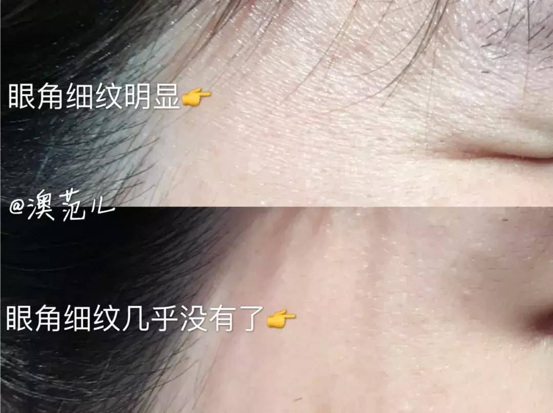 澳洲最好的抗衰老精华,平价抗皱抗衰老精华