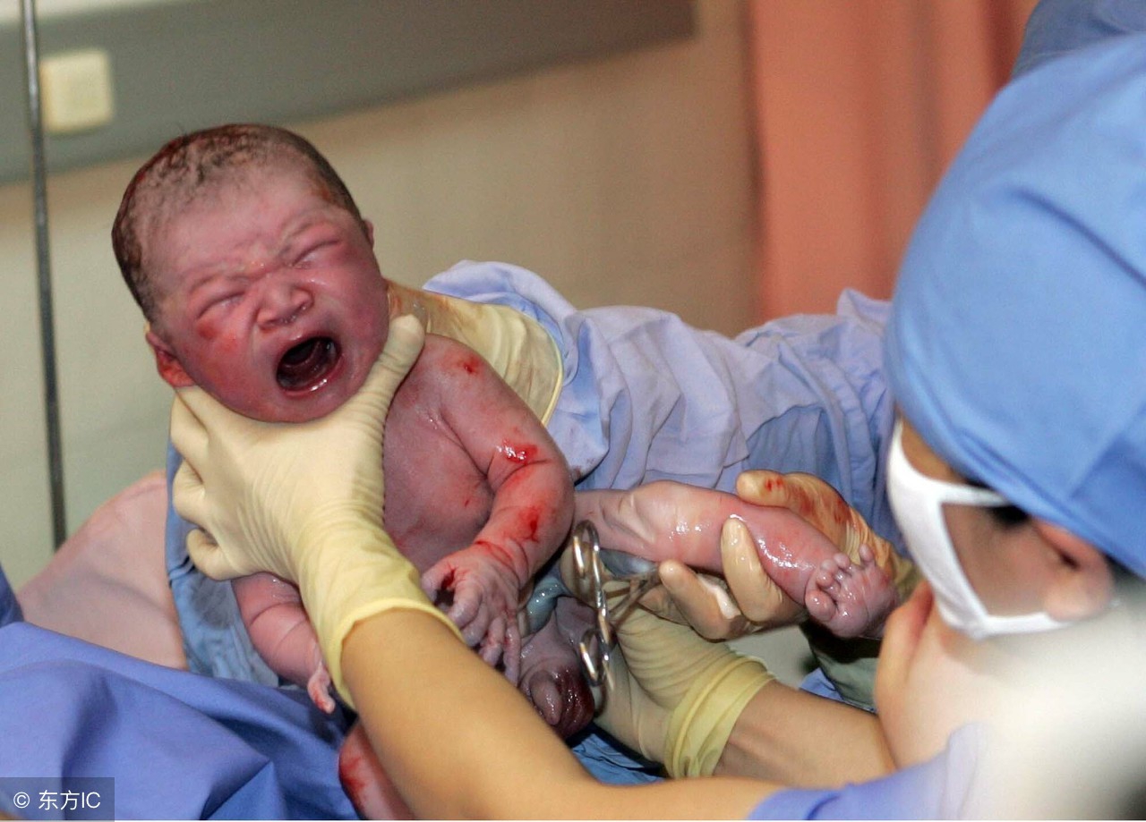 女性做剖腹产手术有什么风险?