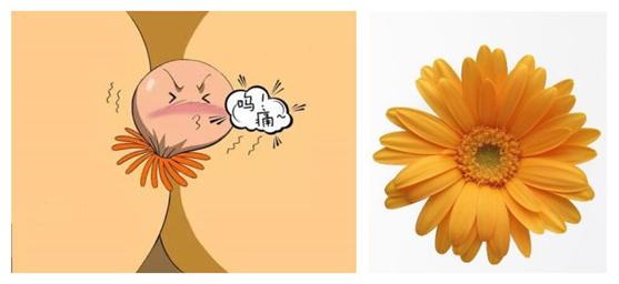 痔疮破裂便血怎么治疗,痔疮便血后身体发虚