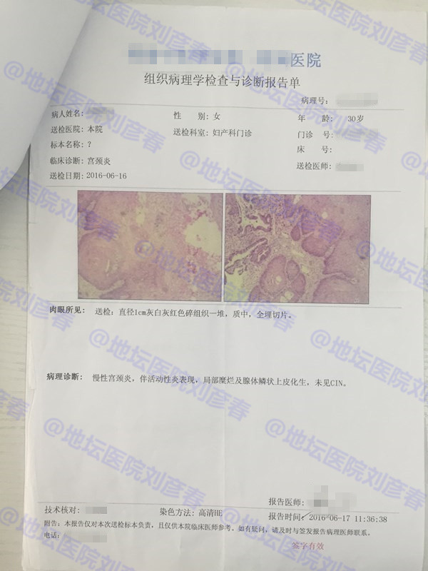 hpv感染分享治愈全过程,感染hpv发作过程的真实案例