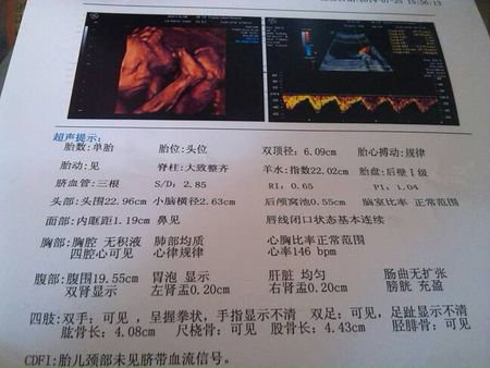 孕期羊水干货知识大全,孕妈妈产检资料收纳册