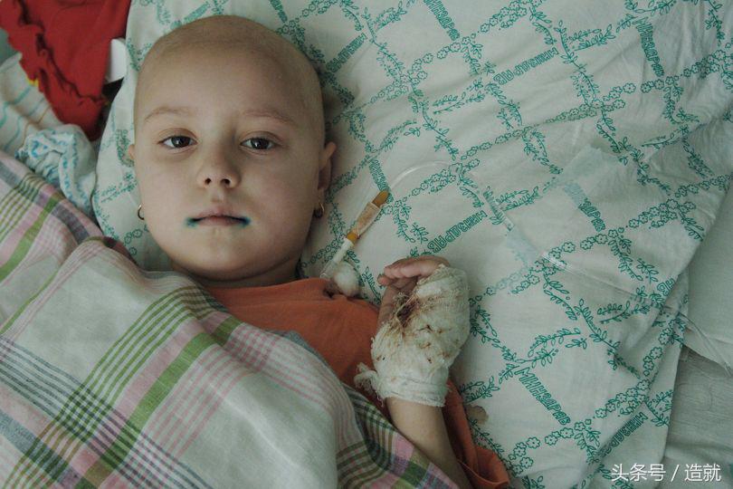 自体骨髓细胞治疗癌症,自体细胞改造治疗癌症