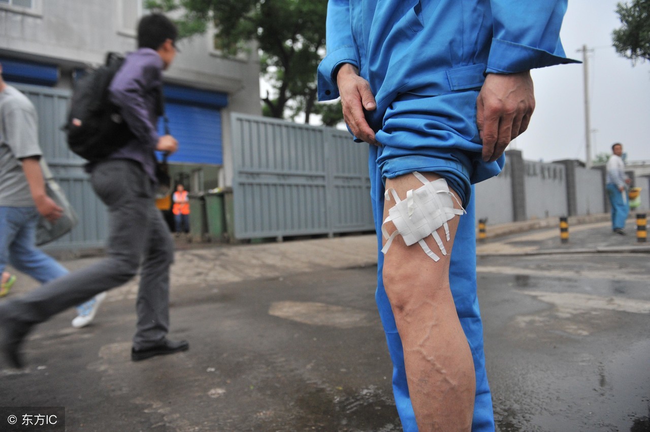 没得狂犬病的狗咬了要紧吗,没得狂犬病的猫被挠了要紧吗