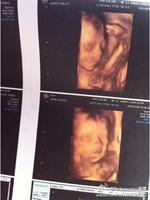 判断自己肚子里的孩子是男是女已全部总结请验收？