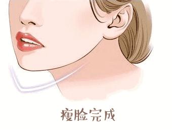 瘦脸针为什么要忌口,瘦脸针禁忌食物