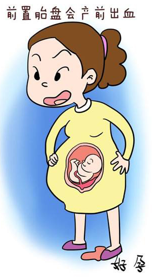 凶险性前置胎盘有多危险看一看吧,前置胎盘的预防方法和护理方法