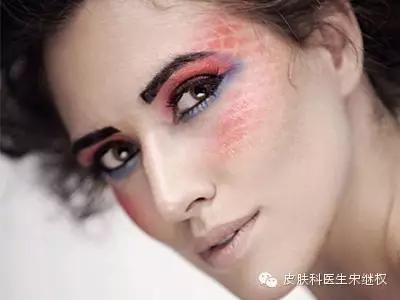 我要的人面桃花，绝不是*血丝红**