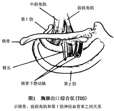 手臂酸麻痛怎么办,老感觉胳膊肩膀酸痛
