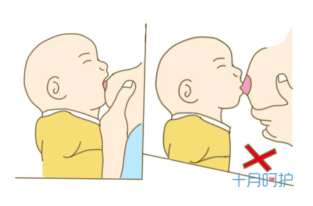 母乳喂养时,新妈妈乳头破裂该怎么修复