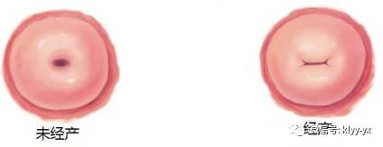 顺产生完孩子多久子宫恢复原状,生完孩子子宫脱落怎样恢复