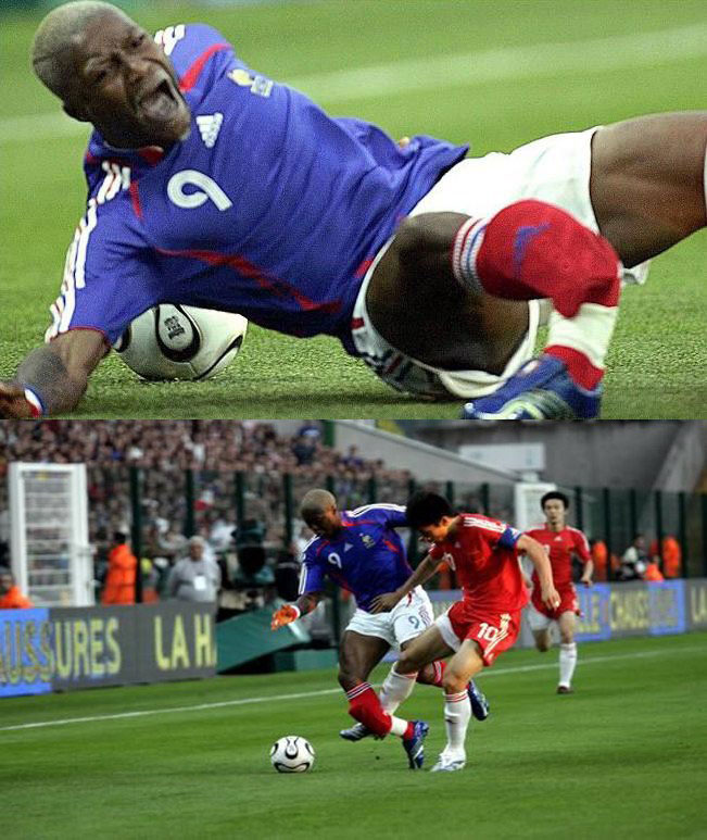 张弛足球比赛中最严重的受伤,足坛受伤感人瞬间