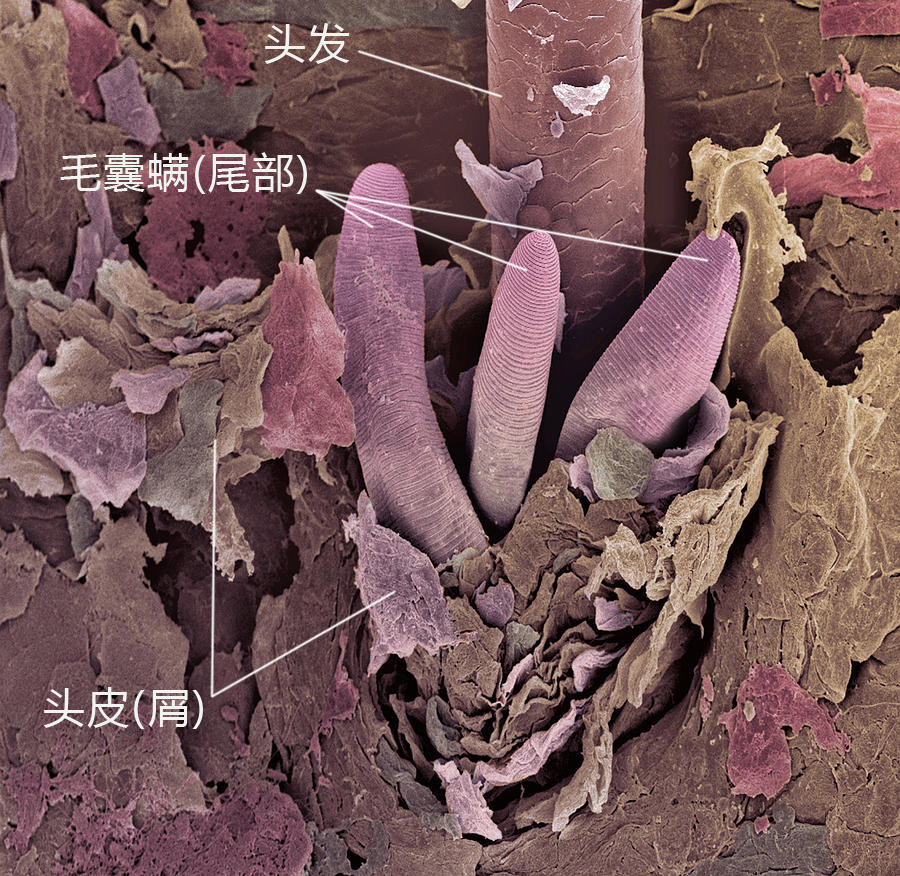 饭前慎入：不怕恶评如潮！揭秘“空调几年不洗就少活几年？”